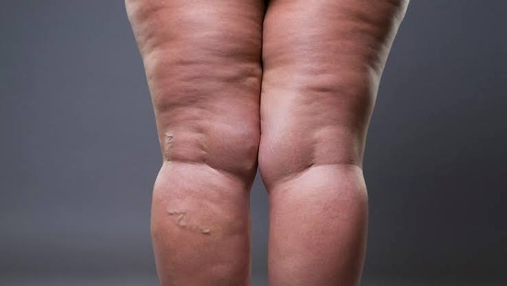 Rear view of legs showing visible skin texture