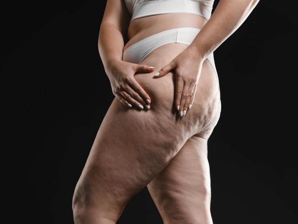Hands resting on the hips and upper thighs showing skin texture
